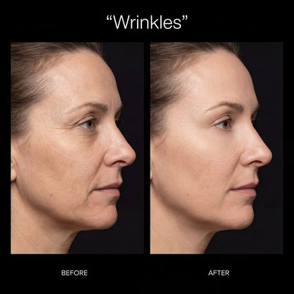 Red Light Therapy Mask