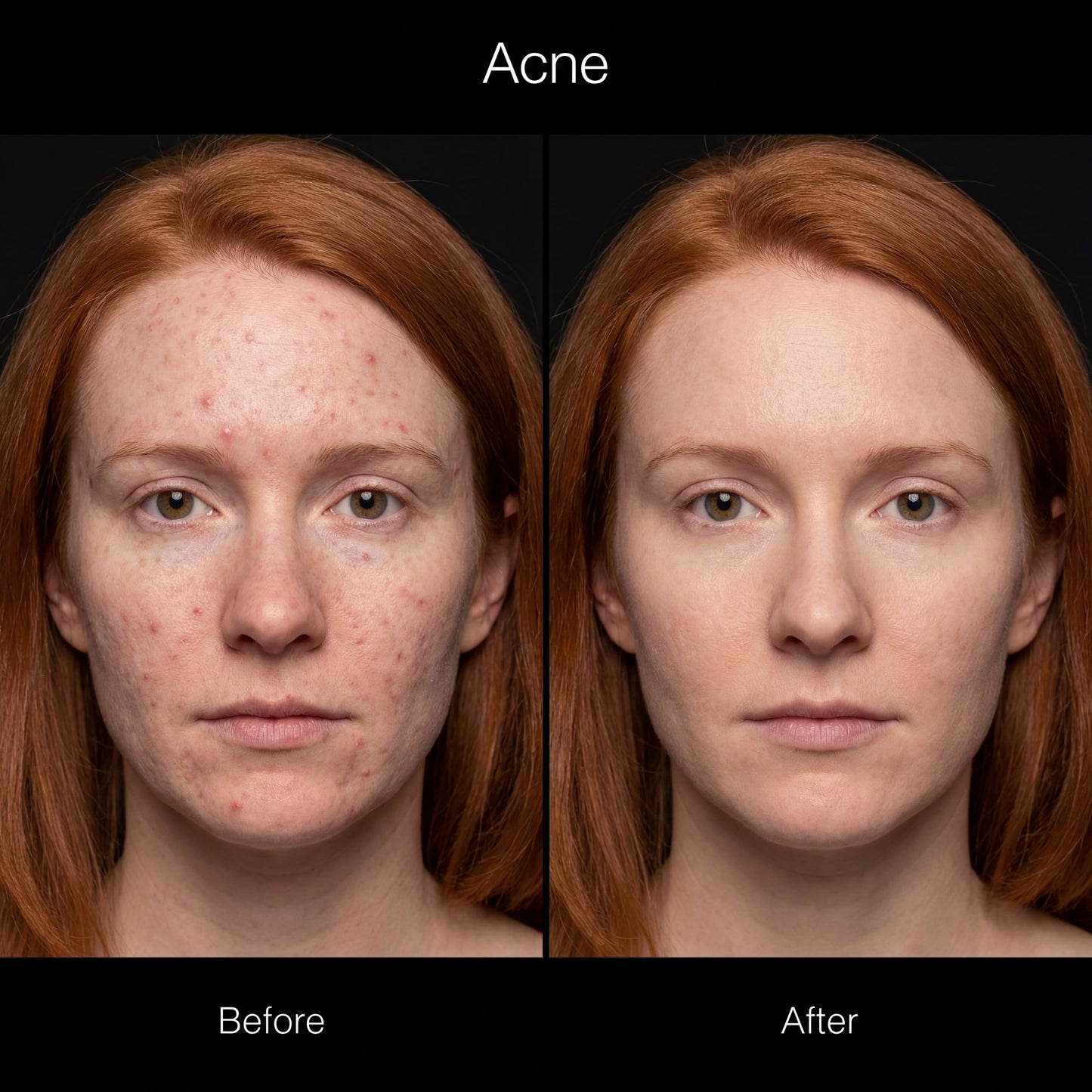 Red Light Therapy Mask